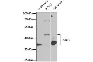 Western blot analysis of extracts of various cell lines, using SIRT2 antibody (ABIN1874785) at 1:1000 dilution. (SIRT2 Antikörper)