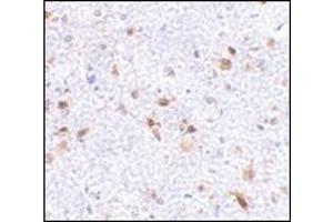 Immunohistochemistry of PDL-2 in mouse brain tissue with this product at 2. (PDCD1LG2 Antikörper  (Center))
