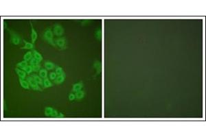 Immunofluorescence analysis of A549 cells, using MMP-11 Antibody. (MMP11 Antikörper  (Internal Region))