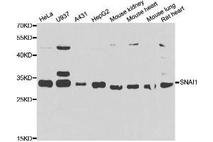Western Blotting (WB) image for anti-SNAIL (SNAI1) (AA 1-100) antibody (ABIN1682836)