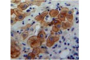 IHC-P analysis of Liver tissue, with DAB staining. (BMP5 Antikörper  (AA 317-454))