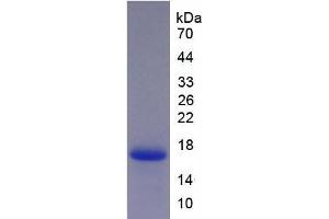 SDS-PAGE analysis of Human Neurokinin B Protein. (Tachykinin 3 Protein (TAC3))