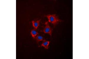 Immunofluorescent analysis of Collagen 4 alpha 5 staining in HeLa cells.
