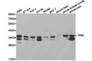 Western Blotting (WB) image for anti-Tropomyosin 1 (Alpha) (TPM1) antibody (ABIN1875180) (Tropomyosin Antikörper)