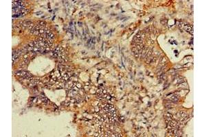 Immunohistochemistry (IHC) image for anti-Guanine Nucleotide Binding Protein (G Protein), beta Polypeptide 4 (GNB4) (AA 105-185) antibody (ABIN7154741)