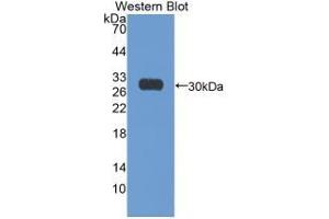 Western Blotting (WB) image for Antigen Identified By Monoclonal Antibody Ki-67 (MKI67) ELISA Kit (ABIN6720578)