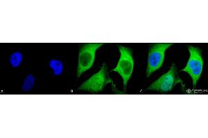 Immunocytochemistry/Immunofluorescence analysis using Mouse Anti-Ubiquitin Monoclonal Antibody, Clone 5B9-B3 . (Ubiquitin Antikörper  (FITC))