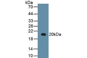 Detection of Recombinant RARS, Human using Monoclonal Antibody to Arginyl tRNA Synthetase (RARS) (RARS Antikörper  (AA 1-146))