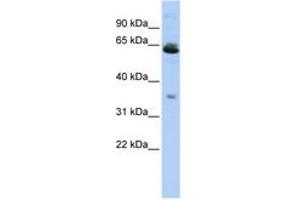 Image no. 1 for anti-Translocase of Outer Mitochondrial Membrane 40 Like (TOMM40L) (AA 107-156) antibody (ABIN6742568) (TOMM40L Antikörper  (AA 107-156))
