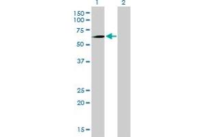 Western Blot analysis of PCK1 expression in transfected 293T cell line by PCK1 monoclonal antibody (M01), clone 3E4. (PCK1 Antikörper  (AA 1-622))