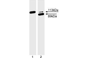 Western Blotting (WB) image for anti-Poly (ADP-Ribose) Polymerase 1 (PARP1) (full length) antibody (ABIN967515)