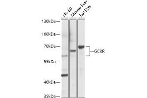Western blot analysis of extracts of various cell lines, using GCKR Antibody (ABIN6131695, ABIN6141014, ABIN6141015 and ABIN6221331) at 1:1000 dilution. (GCKR Antikörper  (AA 1-300))