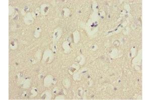 Immunohistochemistry of paraffin-embedded human brain tissue using ABIN7153074 at dilution of 1:100 (FOXN2 Antikörper  (AA 172-431))