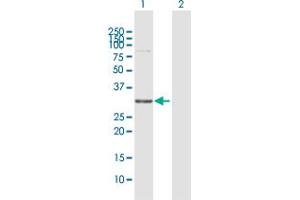 Western Blot analysis of WBSCR22 expression in transfected 293T cell line by WBSCR22 MaxPab polyclonal antibody. (WBSCR22 Antikörper  (AA 1-281))