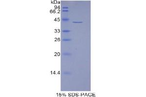 SDS-PAGE analysis of Human HIST1H2AJ Protein.