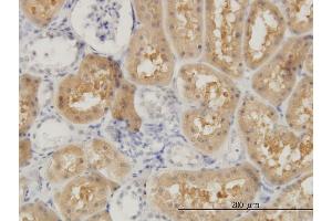 Immunoperoxidase of monoclonal antibody to OCRL on formalin-fixed paraffin-embedded human kidney. (OCRL Antikörper  (AA 146-239))