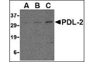 Western blot analysis of PDL-2 in Raji cell lysate with this product at (A) 0. (PDCD1LG2 Antikörper  (Center))