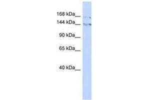 Image no. 1 for anti-Bromodomain Adjacent To Zinc Finger Domain, 1B (BAZ1B) (C-Term) antibody (ABIN6742876) (BAZ1B Antikörper  (C-Term))