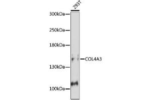 Western blot analysis of extracts of Mouse kidney, using COL4 antibody (ABIN7266460) at 1:1000 dilution. (COL4a3 Antikörper  (C-Term))