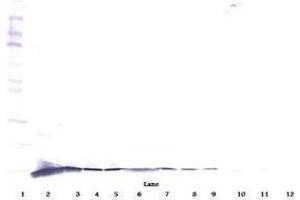 Image no. 2 for anti-Nerve Growth Factor (NGF) antibody (ABIN465645) (Nerve Growth Factor Antikörper)