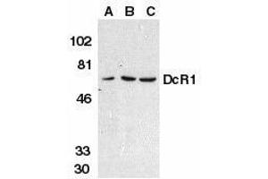 Western blot analysis of DcR1 in HeLa cell (A), mouse (B) and rat (C) liver tissue lysates with DcR1 antibody at 1μg/ml. (DcR1 Antikörper)
