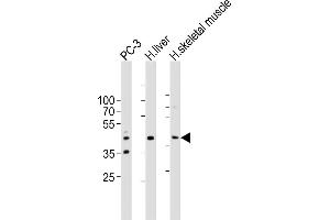 Western blot analysis of lysates from PC-3 cell line, human liver, human skeletal muscle tissue lysate(from left to right), using POC1A Antibody (C-term) ABIN6577916.