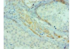 Immunohistochemistry of paraffin-embedded human testis tissue using ABIN7145198 at dilution of 1:100 (BIRC2 Antikörper  (AA 1-300))