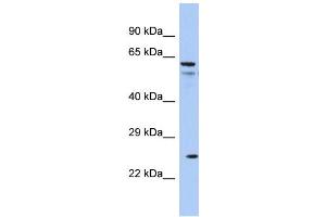 Host: Rabbit Target Name: AQP5 Sample Type: COLO205 Whole cell lysates Antibody Dilution: 1. (Aquaporin 5 Antikörper  (C-Term))