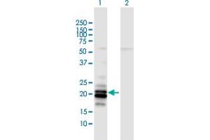 Western Blot analysis of LCN2 expression in transfected 293T cell line by LCN2 MaxPab polyclonal antibody.