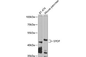 Western blot analysis of extracts of various cell lines, using SPOP antibody (ABIN6130703, ABIN6148374, ABIN6148376 and ABIN6223537) at 1:1000 dilution. (SPOP-B Antikörper  (AA 1-270))