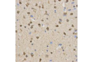 Immunohistochemistry of paraffin-embedded mouse brain using TLE1 antibody at dilution of 1:200 (x400 lens). (TLE1 Antikörper)