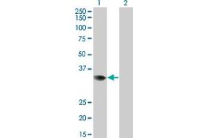 Western Blot analysis of PRPS2 expression in transfected 293T cell line by PRPS2 monoclonal antibody (M02), clone 4C1. (PRPS2 Antikörper  (AA 160-269))