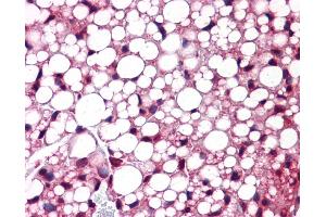 Immunohistochemistry (IHC) image for anti-Activating Transcription Factor 6 (ATF6) (C-Term) antibody (ABIN2779547)