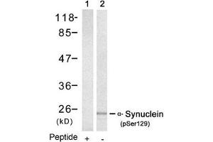 Western blot analysis of extracts from mouse brain tissue using a-Synuclein(Phospho-Ser129) Antibody(Lane 2) and the same antibody preincubated with blocking peptide(Lane1). (SNCA Antikörper  (pSer129))