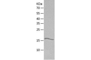 Western Blotting (WB) image for Gastrokine 1 (GKN1) (AA 1-199) protein (His tag) (ABIN7123060) (Gastrokine 1 Protein (GKN1) (AA 1-199) (His tag))
