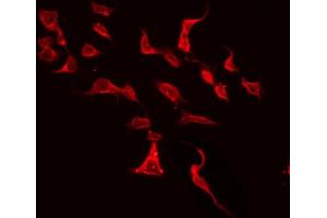 ABIN6272335 staining HeLa by IF/ICC. (KCNJ5 Antikörper  (N-Term))