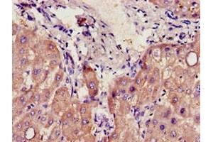Immunohistochemistry of paraffin-embedded human liver tissue using ABIN7142182 at dilution of 1:100 (CYP39A1 Antikörper  (AA 235-392))