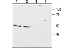 Western Blotting (WB) image for anti-Gastrin-Releasing Peptide Receptor (GRPR) (AA 287-300), (Extracellular) antibody (ABIN7043210)
