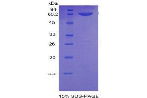 SDS-PAGE (SDS) image for Integrin beta 2 (ITGB2) (AA 451-627) protein (His tag,MBP tag) (ABIN2123782)