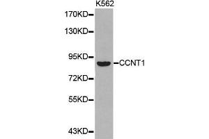 Western blot analysis of extracts of K562 cell lines, using CCNT1 antibody. (Cyclin T1 Antikörper  (AA 220-320))