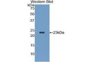 Western blot analysis of the recombinant protein. (Fibrillin 1 Antikörper  (AA 168-364))