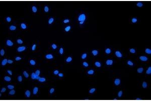 IF analysis of NHEJ1 using anti-NHEJ1 antibody (ABIN7599198).