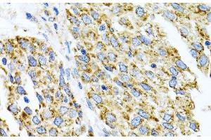 Immunohistochemistry (Paraffin-embedded Sections) (IHC (p)) image for anti-Cytochrome P450, Family 1, Subfamily A, Polypeptide 1 (CYP1A1) antibody (ABIN7010003)