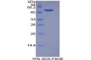 SDS-PAGE analysis of Mouse Integrin alpha 6 Protein. (ITGA6 Protein)
