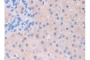 Used in DAB staining on fromalin fixed paraffin- embedded stomach cancer tissue (FIL1d Antikörper  (AA 12-151))