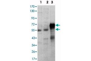 Western blot analysis using ETS1 monoclonal antibody, clone 8A8  against Jurkat (1) , HepG2 (2) and ETS1-hIgGFc transfected HEK293 (3) cell lysate. (ETS1 Antikörper)