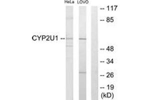 Western blot analysis of extracts from HeLa/Lovo cells, using Cytochrome P450 2U1 Antibody.