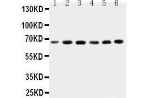Anti-CETP antibody, Western blotting Lane 1: HELA Cell Lysate Lane 2: COLO320 Cell Lysate Lane 3:  Cell Lysate Lane 4: JURKAT Cell Lysate Lane 5: RAJI Cell Lysate Lane 6: MCF-7 Cell Lysate (CETP Antikörper  (C-Term))