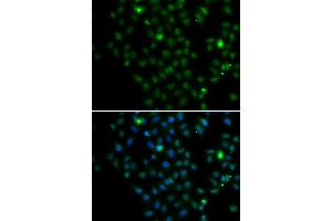 Immunofluorescence analysis of MCF-7 cells using LMO4 antibody (ABIN4904242). (LMO4 Antikörper)