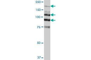 MYLK MaxPab polyclonal antibody. (MYLK Antikörper  (AA 1-992))